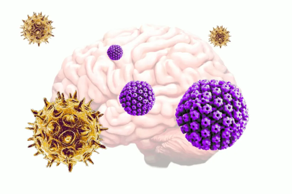A new study speculates the chicken pox virus can reactivate a dormant herpes infection, leading to the development of Alzheimer's disease