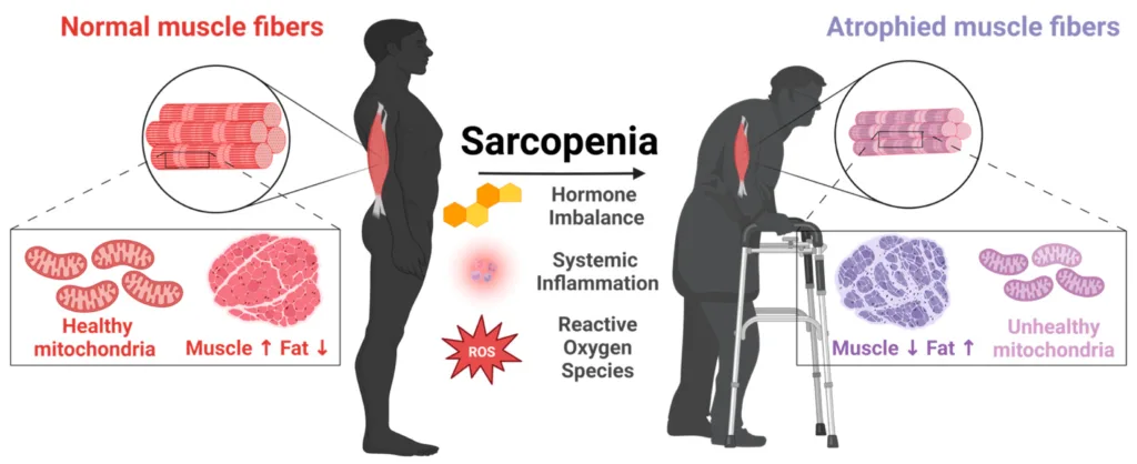 sarcopenia infographic showing young upright man and older man using a walker